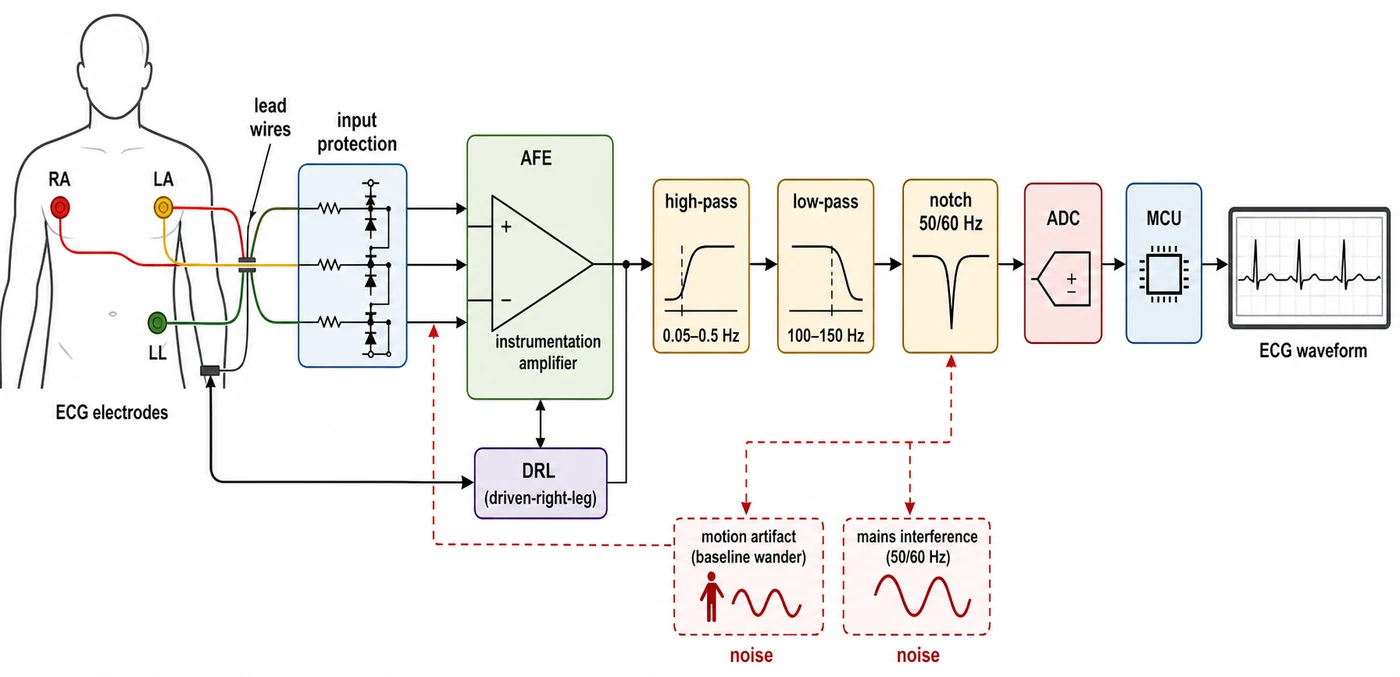 ECG acquisition signal chain from electrodes to analog front end, filtering, and ADC
